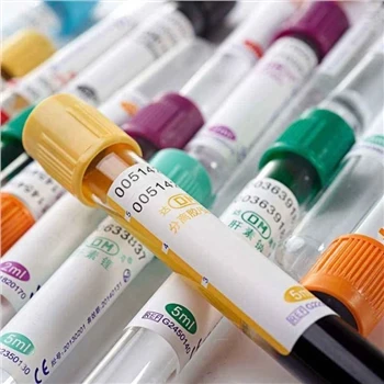 Engangsglas eller PET EDTA/Almindelig/Gel & koagulering/Heparin/ESR Vakuum el...